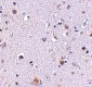 NUP160 Antibody